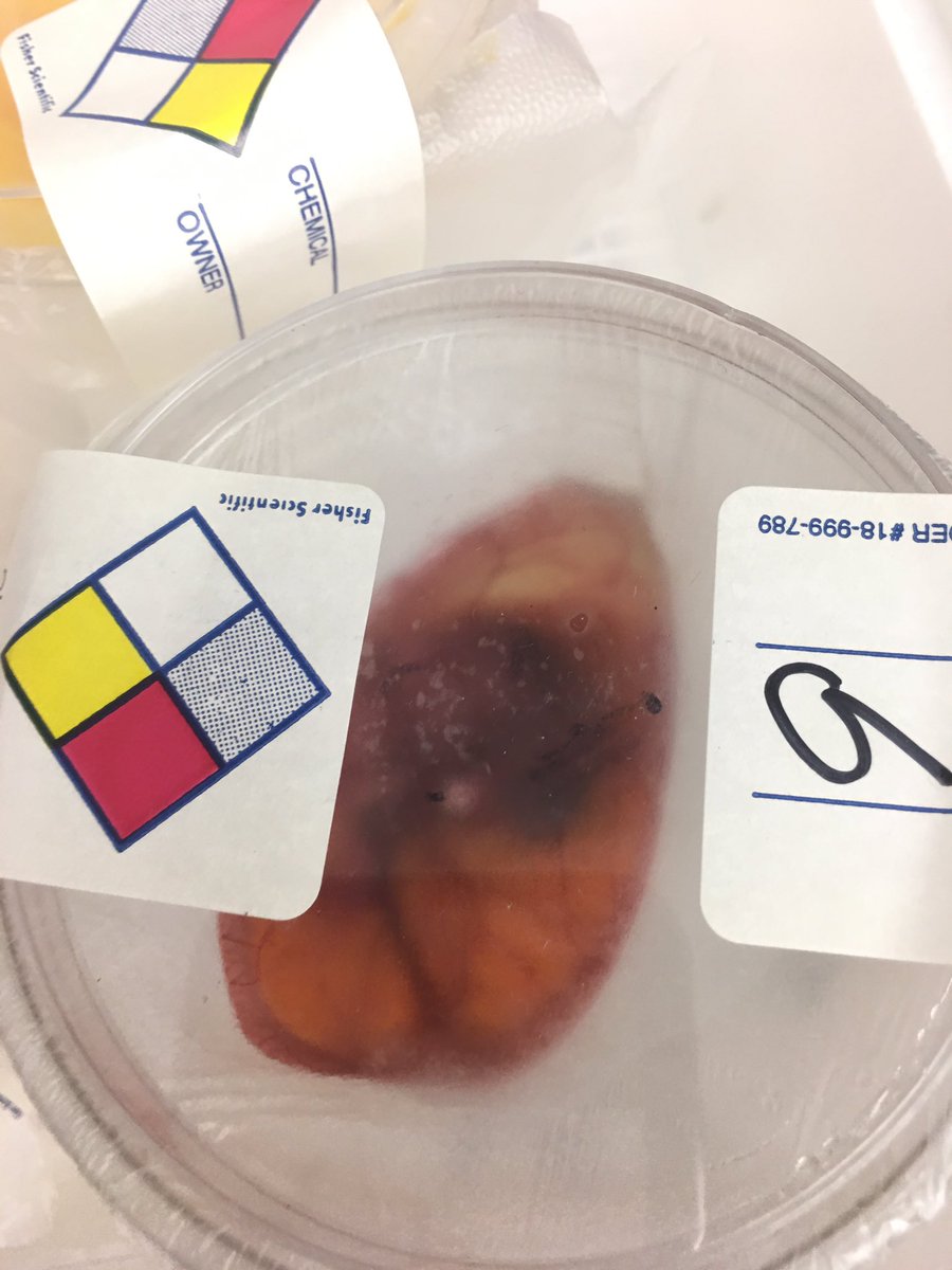 STEMECNCAT's tweet photo. The embryological development of a chick with @BioWall! #12Days #EthicsInSTEM https://t.co/5AdQ4GoEoe