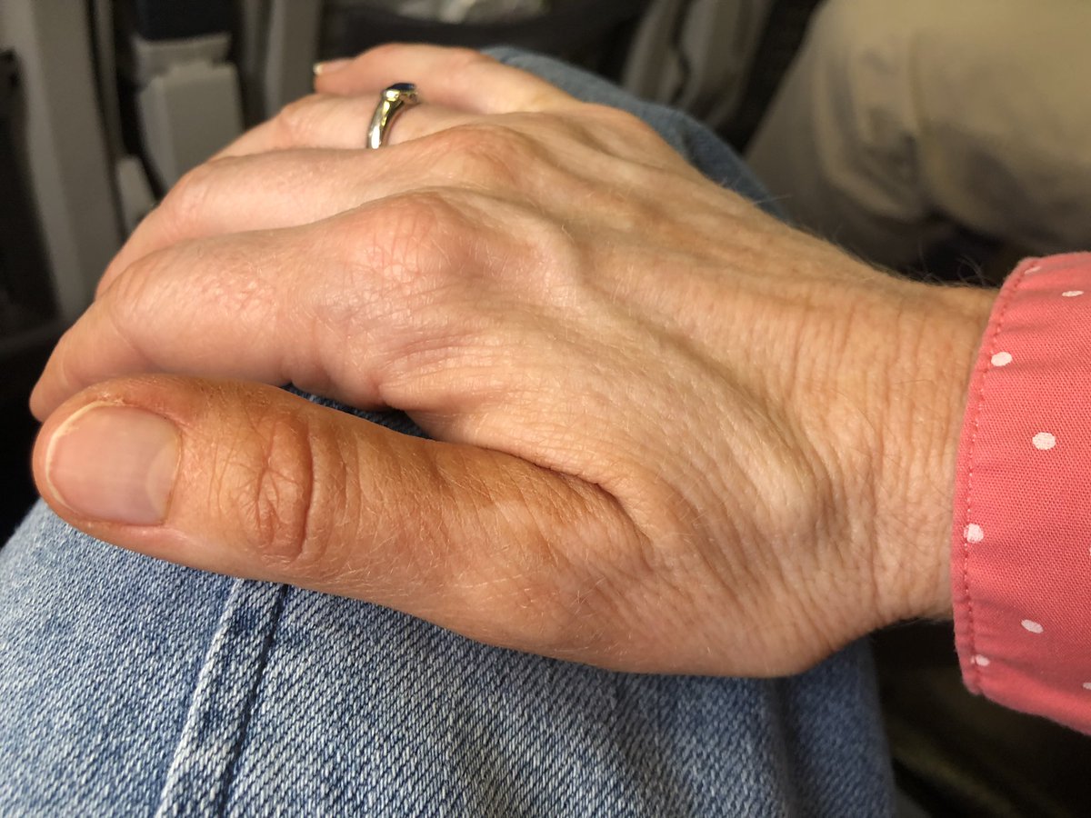 Jody_Robbins's tweet photo. Nobody’s gonna look at my hands or ankles in Cabo, right? #spraytanfail https://t.co/fSjp5xa0BL