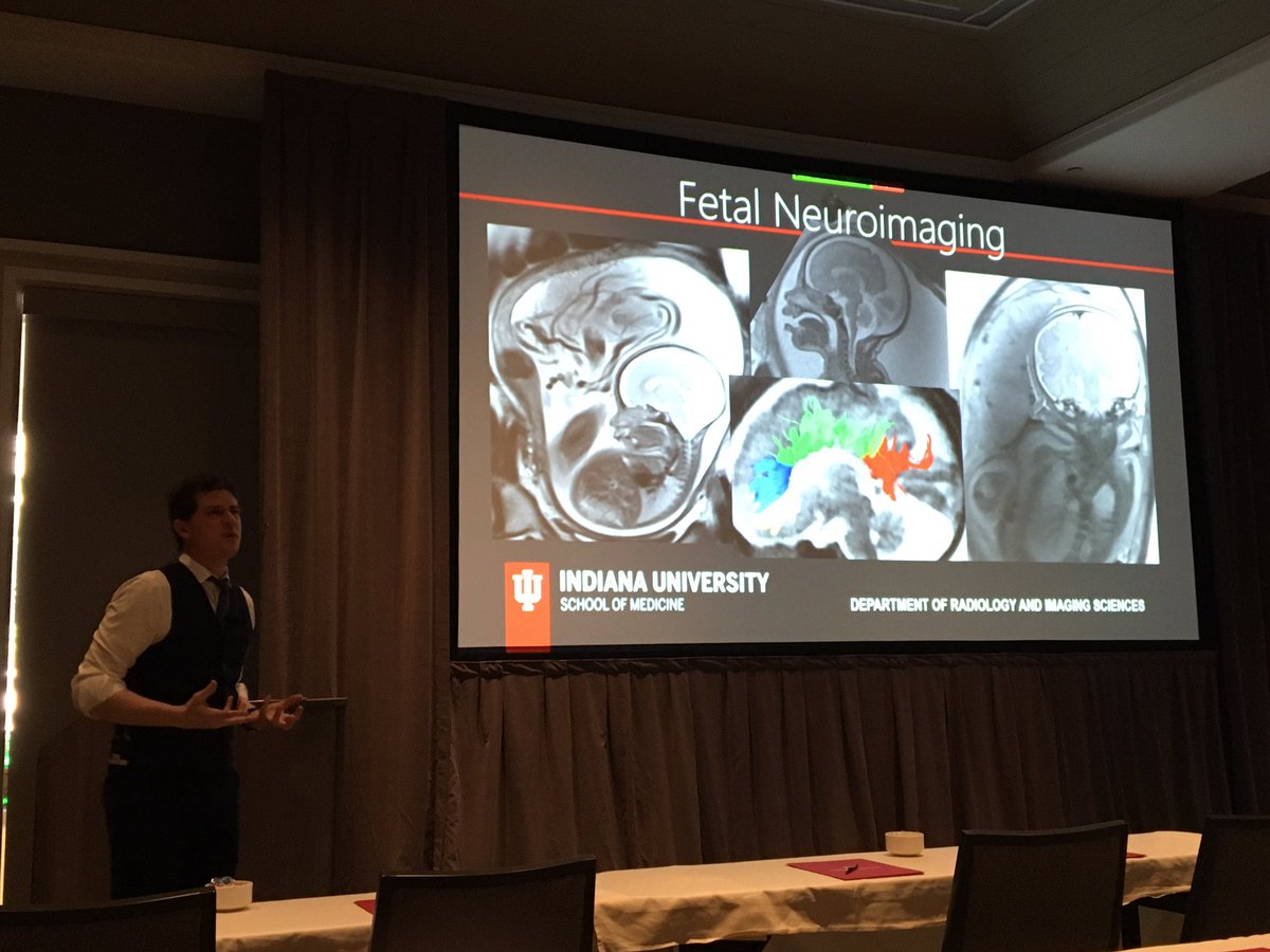 leah_sieck's tweet photo. Amazing fetal #MRI lecture by @brandonbrownmd - so crucial for prenatal diagnosis, family counseling.  @IURadiology imaging update in wine country! https://t.co/pMcORXa6Qp