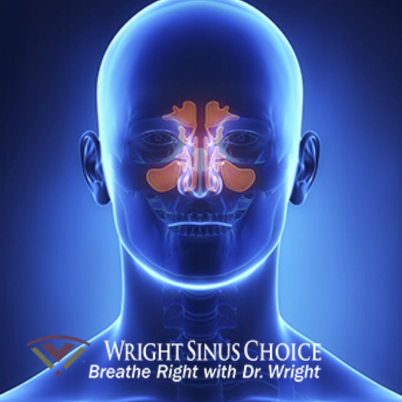 DrWrightSinus's tweet photo. If you're experiencing a consistent headache, stuffy nose, fever, sinus pressure, difficulty breathing through the nose, or any similar symptoms, you might have sinusitis. Call us today to schedule an appointment or if you have any questions. 956-998-6673 https://t.co/YXe7NVWw0G