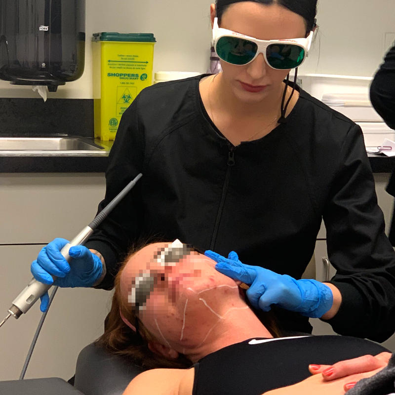 SereneRadiance's tweet photo. We get it, acne can be annoying, embarassing and it can actually cause pain! With laser acne treatment, a laser penetrates the skin without causing any pain. It can also accelerate the healing process and stimulate collagen remodeling! #yeg #yegbeauty https://t.co/EG6ZwkmJXh