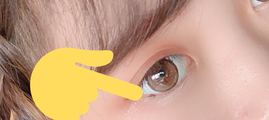 行く メンタル 能力 目 の 粘膜 ほくろ Matsumoto Denki Jp