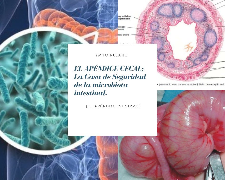 DrCant's tweet photo. El apéndice cecal, ese órgano que siempre hemos creido inútil, segmento atrofiado del#intestino, producto de la SuperEvolución del hombre... "Hoy cobra protagonismo, y se declara protector de nuestras bacterias beneficas y por lo tanto nuestro protector" @Gut_BMJ @InciSioNGlobal https://t.co/FE4IMY322P