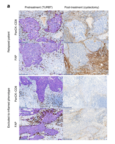 mmw_lmw's tweet photo. #NeoAdjuvant #CheckPointBlockade | #ClinicalEfficacy and #BiomarkerAnalysis in metastatic #Urothelial cancers | Thomas Powles @QMUL @NatureMedicine https://t.co/zmqNNuiBtC https://t.co/AEoWmo7kQN