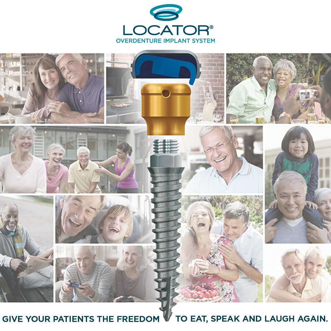 ZestDent's tweet image. ⭐️ SPECIAL OFFER ⭐️  Treat more patients with the LOCATOR® Overdenture Implant System - now available in 3.4mm for Standard Ridges! bit.ly/LODI-Offer

#ZestDentalSolutions #ZestLOCATOR #LOCATORLife #DentalImplants #ImplantDentistry