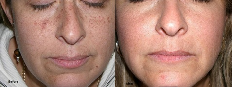 If excess sun this summer has damaged your skin, we offer a complete line of medical-grade products and treatments that, when combined together, can remove even the most stubborn pigmentation. Visit our website to learn more! 1l.ink/DZ5B2F4