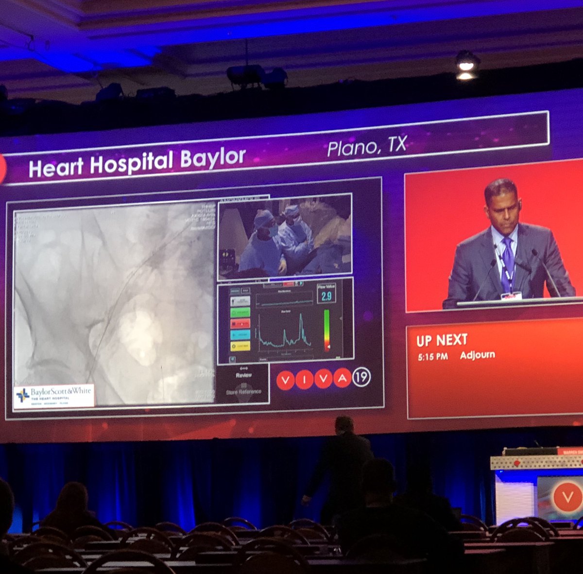 Peter@InRoadMedical (@pschneidermd) on Twitter photo While Dr. Schneider is quite familiar with this procedure, I am watching my first live case as Dr. Tony Das performs life saving procedures.
I have enjoyed #VIVA19 approach bringing cutting edge technology to a conference setting.
-W. Brown While Dr. Schneider is quite familiar with this procedure, I am watching my first live case as Dr. Tony Das performs life saving procedures.
I have enjoyed #VIVA19 approach bringing cutting edge technology to a conference setting.
-W. Brown