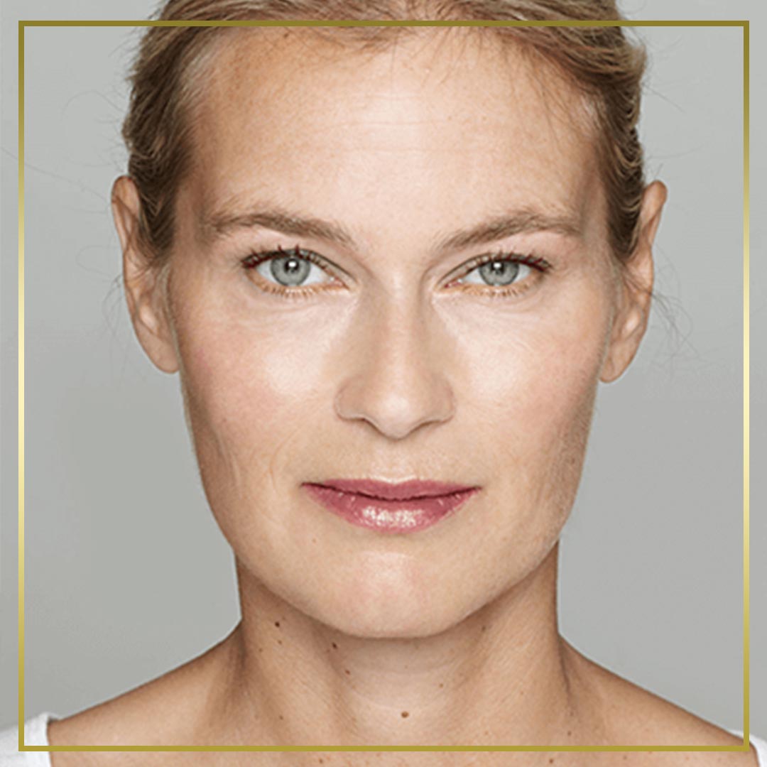 CMarest's tweet photo. 📢¡Tener el rostro que siempre has deseado es posible sin cirugía!

🔸Con la remodelación facial o bioplastia conseguirás esos ángulos y volúmenes soñados con un tratamiento mínimamente invasivo, sin anestesia y en tan solo media hora.

🔸https://t.co/5QByHU5Gs5 https://t.co/UwTDWHUxpO