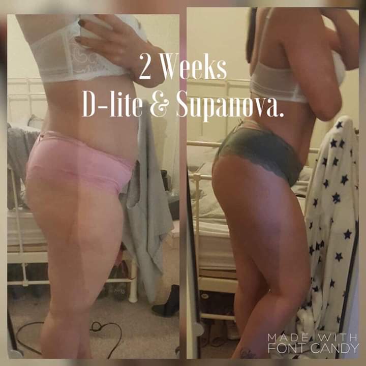 AdelleH83946564's tweet photo. Boom. 2 weeks results From D-LITE &amp;Supanova 

https://t.co/t7DXJ8jI1X

#weightloss #liquidshot #SUPANOVA #GETFIT #WORKOUT #weeklysupply #amazing #UK #Iraland #USA https://t.co/Leo9qfmLn6