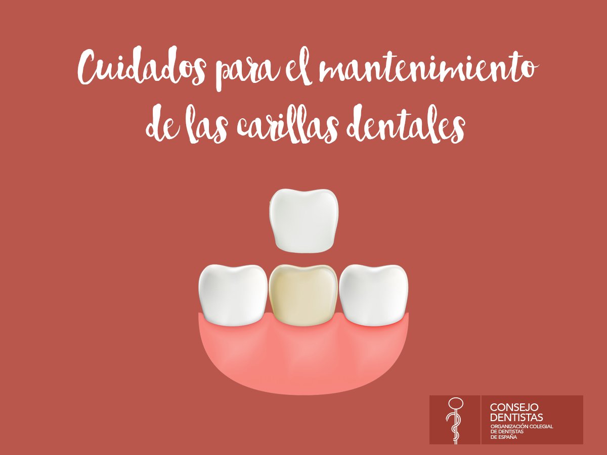 Mantenimiento de las carillas dentales