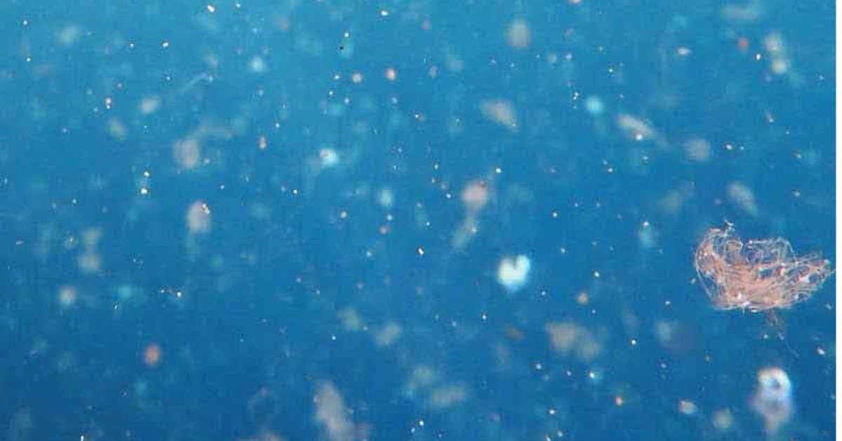 What happens when plastic breaks down?
Reveal the unseen at up to 1000x with the Em1 microscope - Powerful, Portable Microscopy.
.
#em1microscope  #plasticpollution  #microplastic  #waterpollution  #marinepollution #endplasticpollution  #plasticfree  ow.ly/9uZu50x1CGx