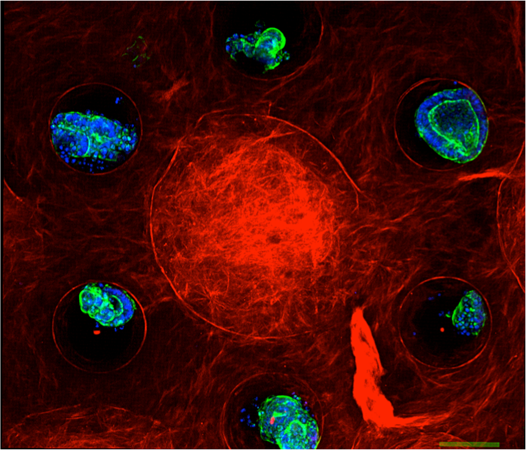 ScienceCQFD's tweet photo. @NatachaTriou @franceculture @Numerama @Sciences_Avenir @GidrolXavier @PourlaScience Reportage par @Ce_LZN > Itw de Stéphanie Descroix @institut_curie @CNRS à @ipggmicrofluid sur la conception d’un organe sur puce d’intestin par la #microfluidique #IPGG #LaMethSci https://t.co/pxR9anyNOa