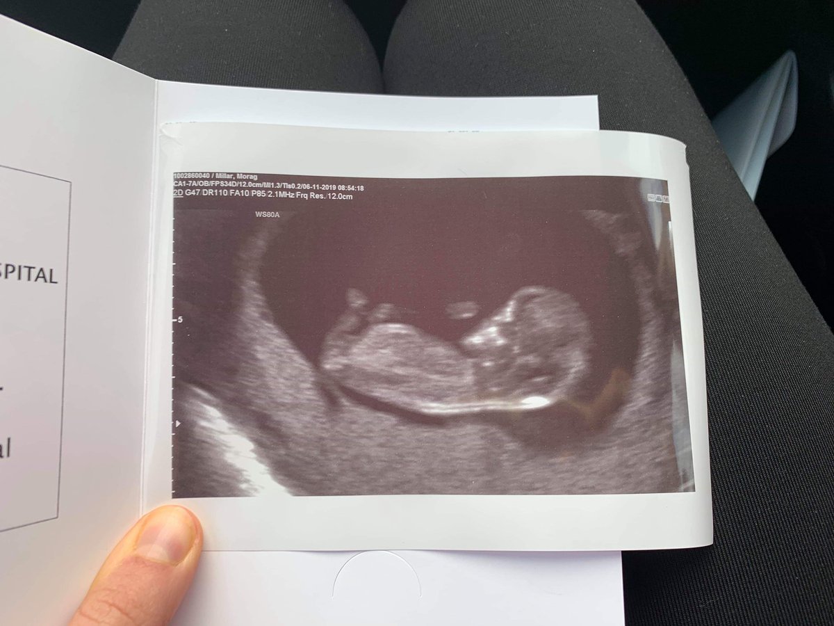 @MoragMacLarty and I are delighted to announce that wee Baby Millar is due 24th May 2020 #centralbaby