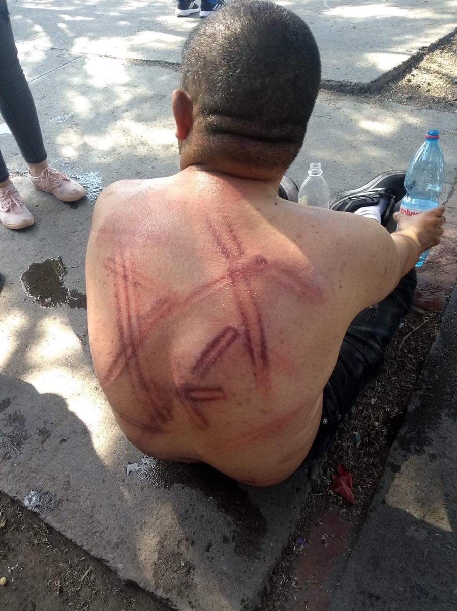 BAncacoy's tweet image. Hoy en Puente Alto, mi tío iba cruzando la calle con las manos arriba (en señal de inocencia), se dirigía a la Fiscalía y fue agredido cobardemente por una decena de Carabineros que así lo dejaron. Esto no era marcha ni otra cosa, lo agarraron de la nada.

#INDH @inddhh