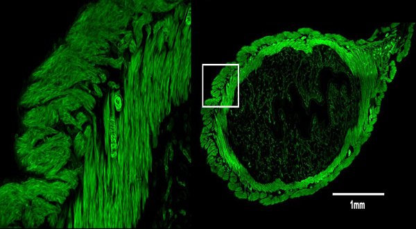 Help <a href="/ASU/">Arizona State University</a> and @ASUBiosciences get noticed! Vote in the <a href="/ASCBiology/">American Society for Cell Biology</a> GFP Image competition. Our very own Bukola O and Page B submitted the GFP Lifeact Mouse Uterus image which contains over 1100 stitched images. Vote at ascb.submittable.com/gallery/26c06a… <a href="/ASUBiodesign/">Biodesign Institute at Arizona State University</a> <a href="/ASUResearch/">Arizona State University Research</a> <a href="/dr_page/">Page Baluch</a>