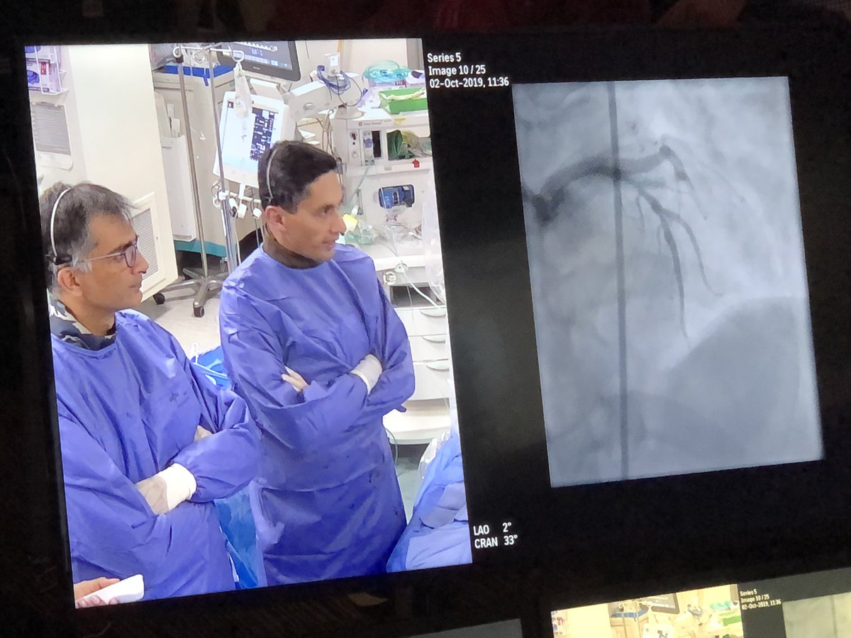 SukhNijjer's tweet photo. Glad to show a recorded case of LAD/D1 bifurcation PCI performed at @ImperialNHS at #IVCC2019: treated with pre-PCI IVUS to both vessels for planning, DK-Crush and followed by IVUS to both for optimisation. Great observations from @Ryvetsprog & Grube, Di Mario & Colombo on panel https://t.co/koG54kxt6U