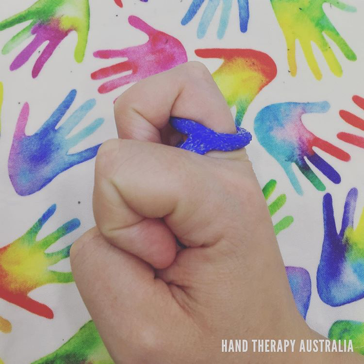 Orfit's tweet photo. This creative Orficast orthosis blocks the MP Joint for the treatment of trigger finger.

Fabricated by @handtherapyaustralia (Instagram)

#HandTherapy #OrthoticFabrication #Orficast #TriggerFinger https://t.co/i1jsrjXHbS