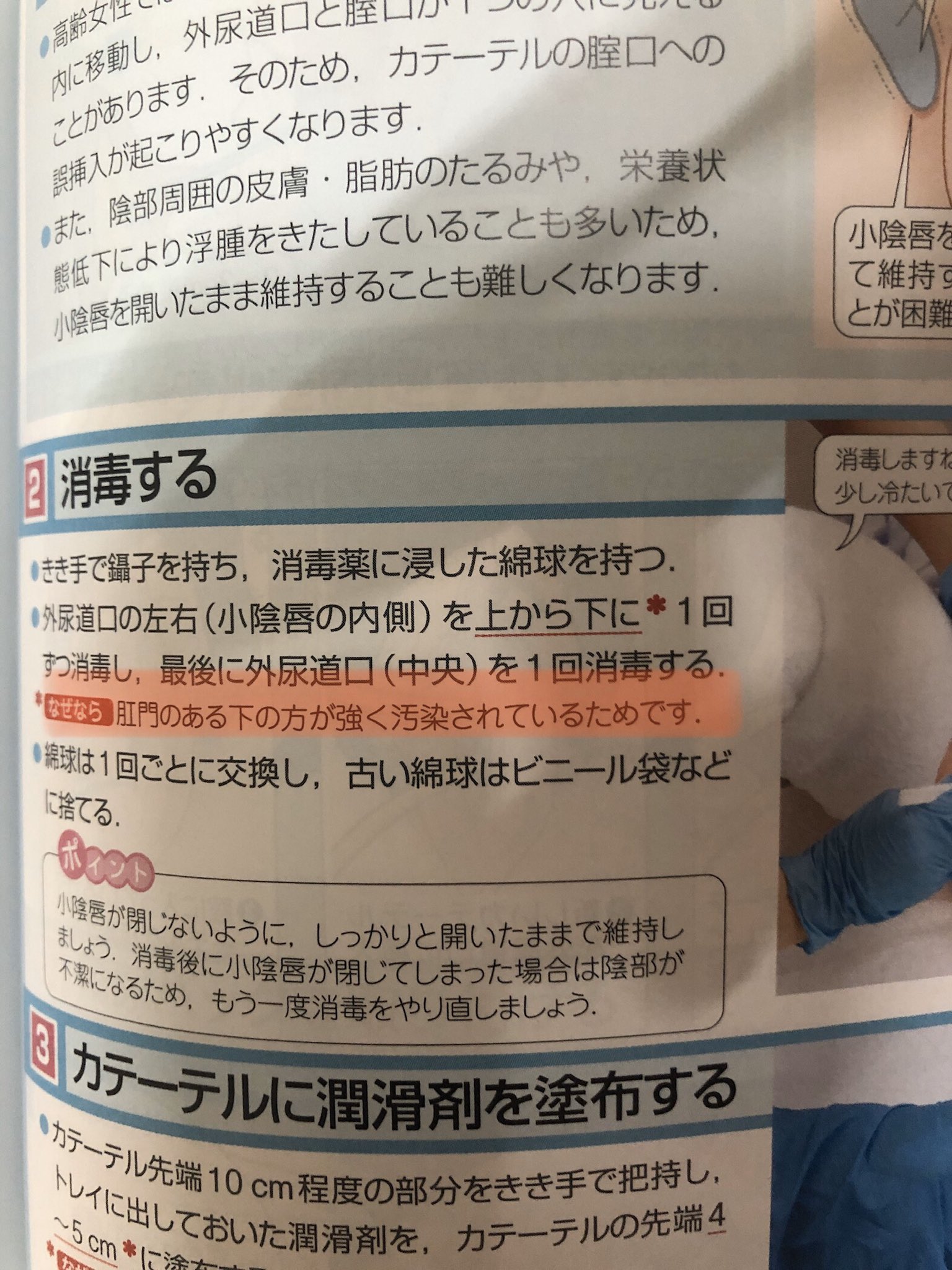 Ambiate Nurse 陰部の消毒について解説があり 外 外 内の手順で技術書には記載されていました 手順については今後統一して行った方が良さそうですね ここが曖昧だと新人nsは お局の対象にされてしまうので 小泉 T Co Pca2w3lo0t