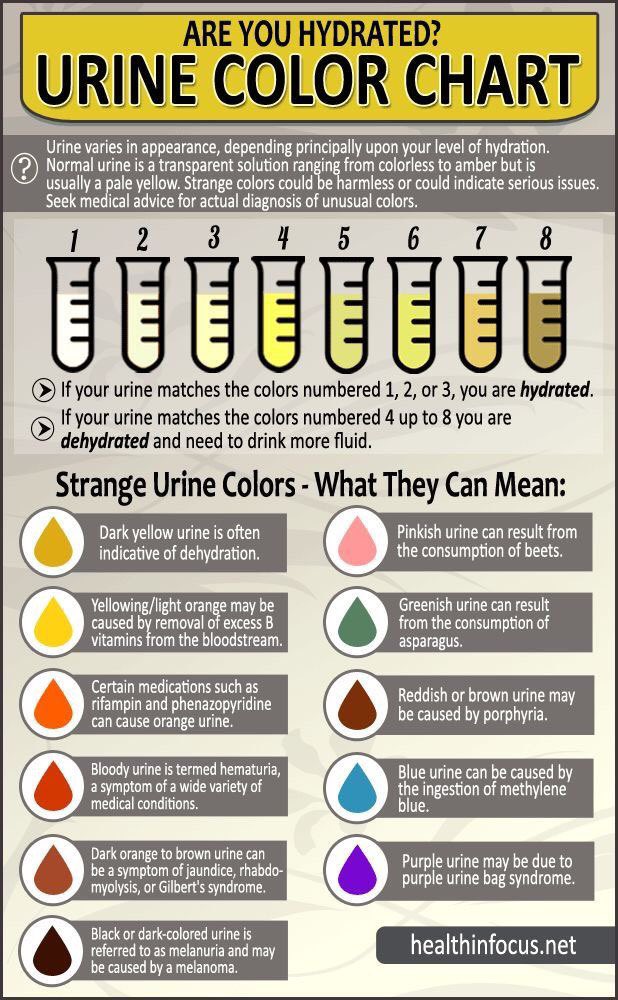 TripleE_KSA's tweet photo. Colors of urine and indication of each color ✨.
#urinary_system https://t.co/sMsFf5I8KZ