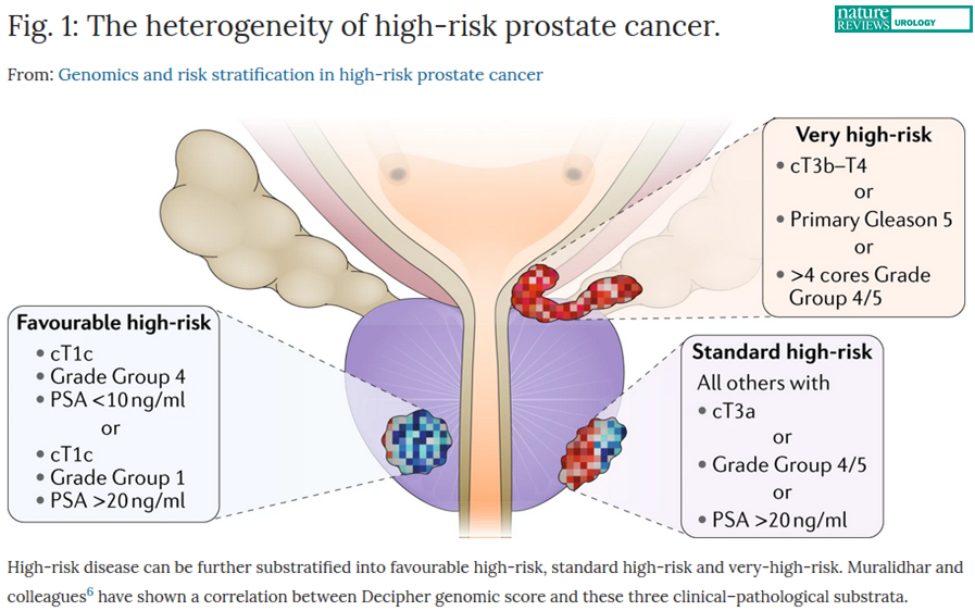 What is intermediate prostate cancer