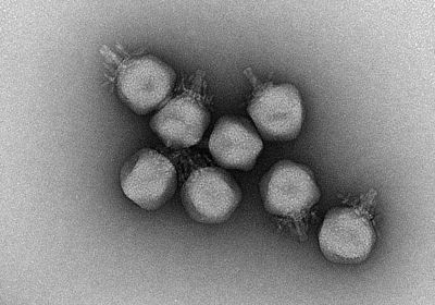 MSBProgram's tweet image. The resident bacteriophages of your gut are still largely a mystery, although there's hopes to change that. Researches studied the virome of 10 adults over a year to start getting a baseline for the unknown phages that inhabit our guts. #microbiome #virus buff.ly/36DuBLk