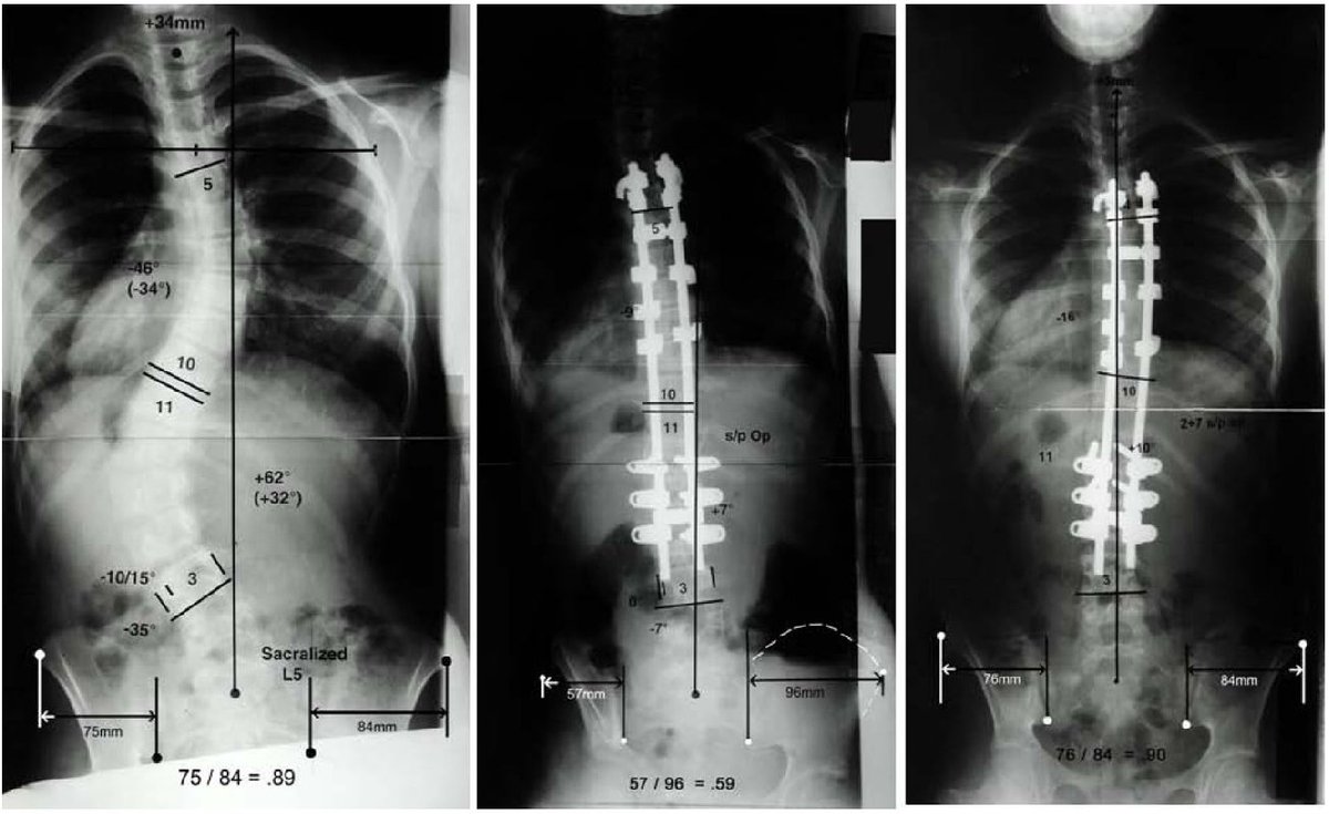 BERENICE OLMEDO

Toraco-Lumbo
[SKOLIÓPHYSIS]

OPENING NOVEMBER 16
INAUGURACIÓN 16 DE NOVIEMBRE 
6-9PM
