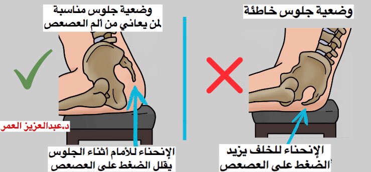 يندم السلطة بقايا اسباب الم العصعص عند النساء Comertinsaat Com