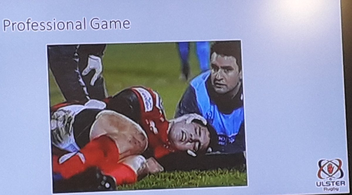 nualak1's tweet photo. Intriguing #showcase from Dr Michael Webb @UlsterRugby on #innovation and #qualityimprovement around #concussion Management & #injuryrecognition #involvefest2019 https://t.co/fP7lwz23iz