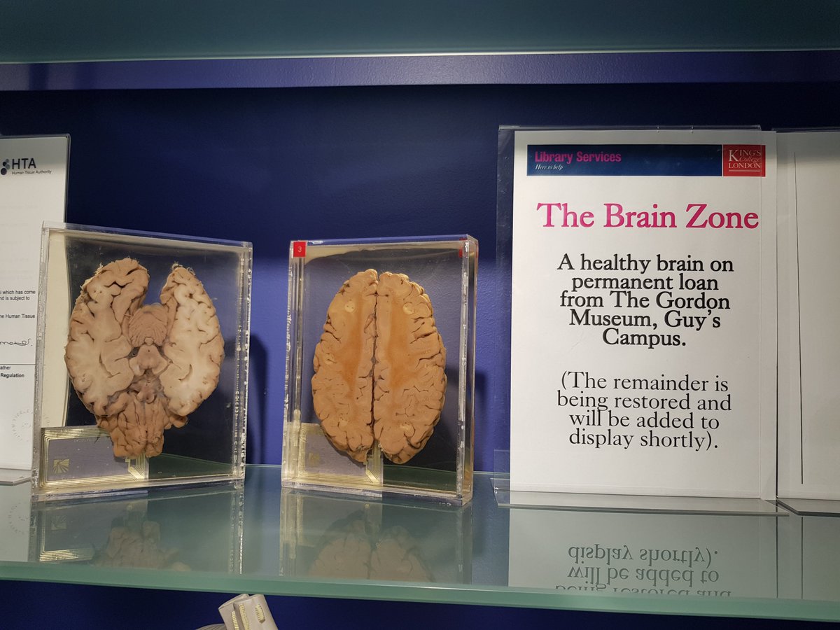 NeuroChampions's tweet photo. Enjoying some time @KingsIoPPN library's #brainzone #gamesforbrain #neurosicenceoverload 🧠 ❤️ https://t.co/9CYJGvPqIE