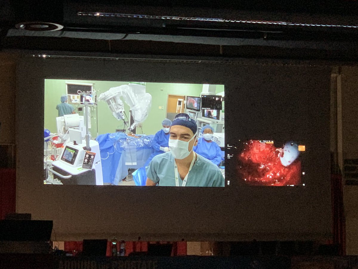 Around the Prostate 2019 (@aroundprostate) on Twitter photo <a href="/SimoneCrivella2/">Simone Crivellaro</a> Streaming from Chicago performing #SinglePort robot assisted laparoscopic radical prostatectomy
Nice and stimulating Moderation by <a href="/KarenFransis/">Karen Fransis</a>
<a href="/aldomassimo10/">Aldo Bocciardi</a> <a href="/UOnlus/">UAN onlus Urological association Niguarda</a> <a href="/DrTortolero/">Leonardo Tortolero</a> <a href="/SimoneCrivella2/">Simone Crivellaro</a> Streaming from Chicago performing #SinglePort robot assisted laparoscopic radical prostatectomy
Nice and stimulating Moderation by <a href="/KarenFransis/">Karen Fransis</a>
<a href="/aldomassimo10/">Aldo Bocciardi</a> <a href="/UOnlus/">UAN onlus Urological association Niguarda</a> <a href="/DrTortolero/">Leonardo Tortolero</a>