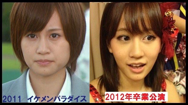 みんながつぶやく整形した芸能人のビフォーアフターツイートのまとめ Cureco Beta みんながつぶやく整形した芸能人のビフォーアフターツイートのまとめ Cureco Beta