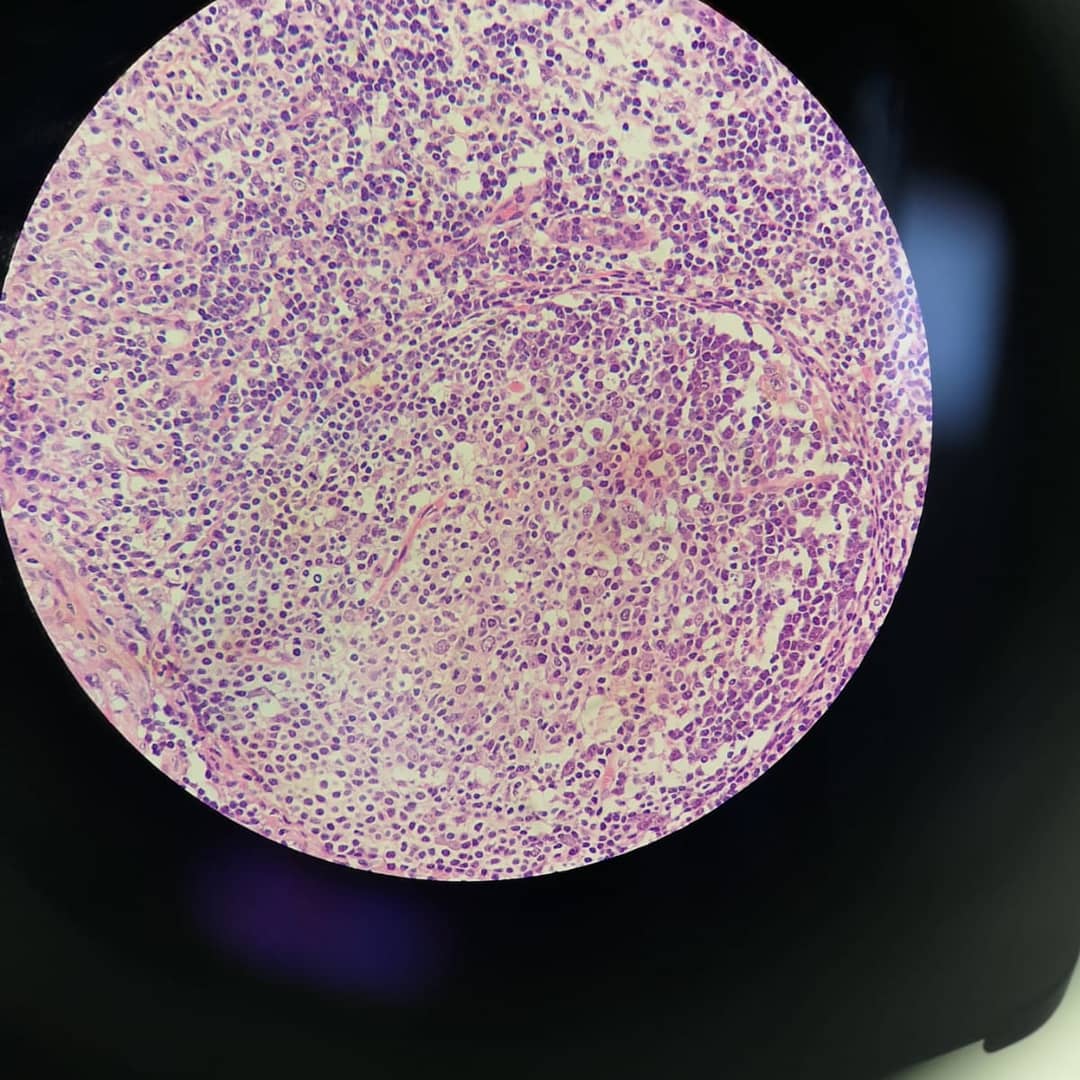 UoCMedSci's tweet photo. Today level 5 students are in the lab staining primary and secondary lymphoid tissues to visualise the areas of the lymphatic system which are involved in the generation of immune cells 

#MD5026 #Immunology #histology  #ChesterMedicalSchool #uochester #MyChesterStory https://t.co/0XXbtw4r6O