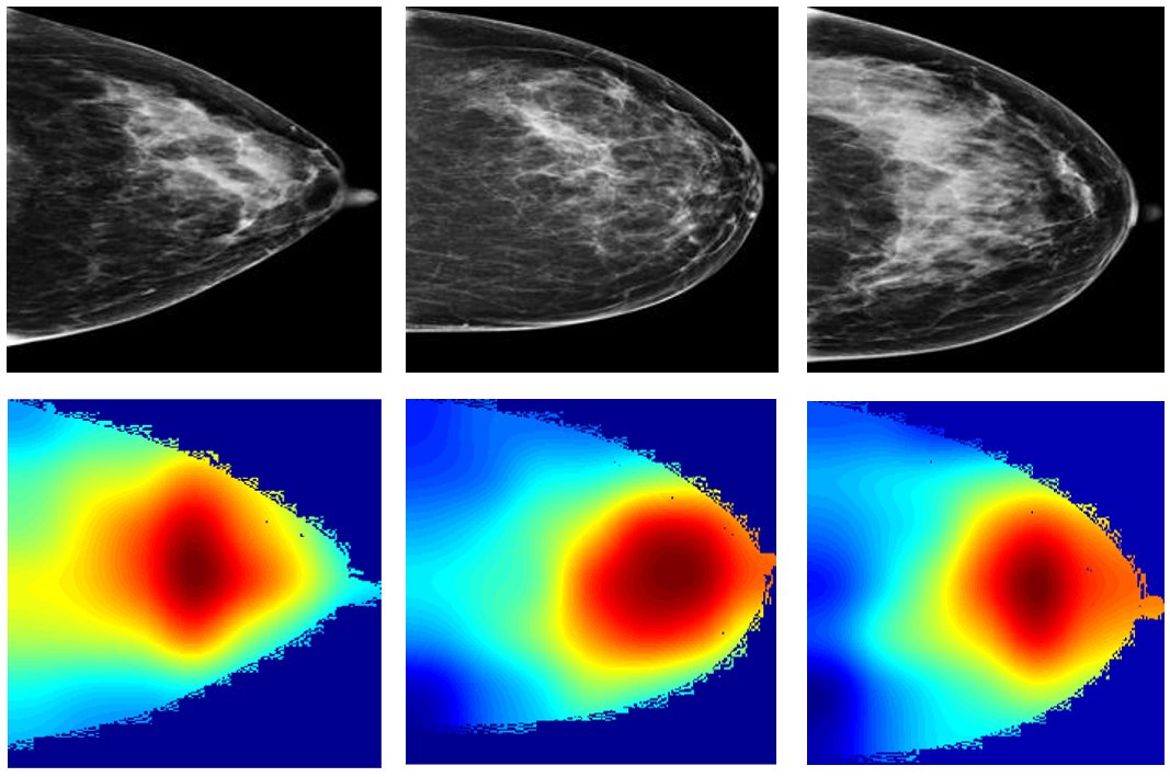 psc_live's tweet photo. Peace of mind through AI: #DeepLearning #ArtificialInteligence on #PSCBridges and #PSCBridgesAI promises fewer false alarms and early prediction of breast cancer development https://t.co/oVWjbDrZGl https://t.co/6KJJD7Z8d3
