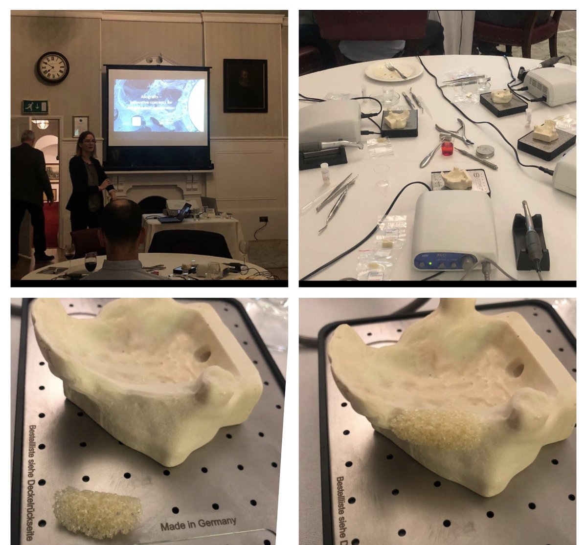CharltonRDental's tweet image. Learning never ends! 🤓The latest in implant block grafting techniques and advances in new materials expected in the next few years!🤩
 #ITIBristolStudyClub #BOTISS #Biomaterials #Straumann #Dentalimplants #tomorrowsdentistrytoday #charltonroaddental #learningneverends