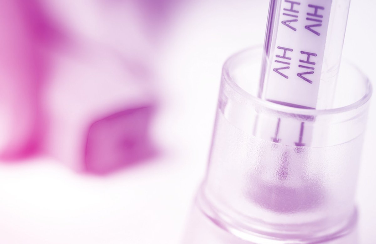 aidsmap's tweet image. Want to find out more about HIV testing this #NHTW? Visit our testing section on aidsmap for a wide range of pages covering HIV and home HIV testing, window periods, accuracy of different tests, and the sensitivity and specificity of tests. aidsmap.com/topic/testing-… #NHTW19