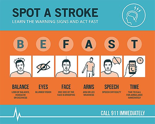 Know the signs of a stroke and #BEFAST Thank you all for your prayers and support!❤️ #pennystrong #strokeawareness