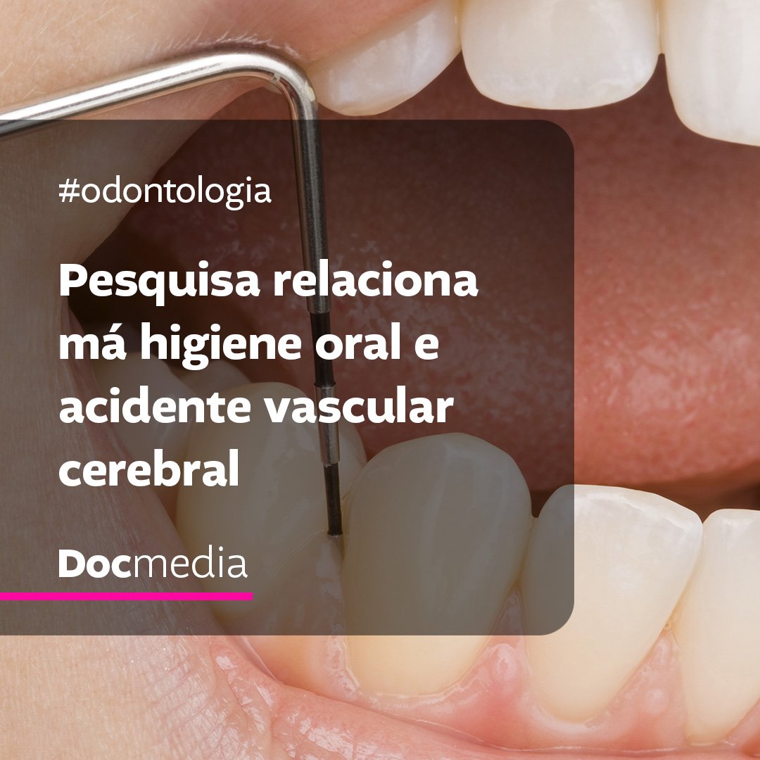 Docmedia_br's tweet photo. Pesquisadores da Universidade de Tampere, na Finlândia, publicaram num artigo perturbador sobre a relação entre a má higiene oral e a ocorrência de acidente vascular cerebral. Quer saber mais?
.
https://t.co/6In2mzf0oD
.
#docmedia #saúde #odontologia #neurologia #medicina https://t.co/6w4bspU2nK