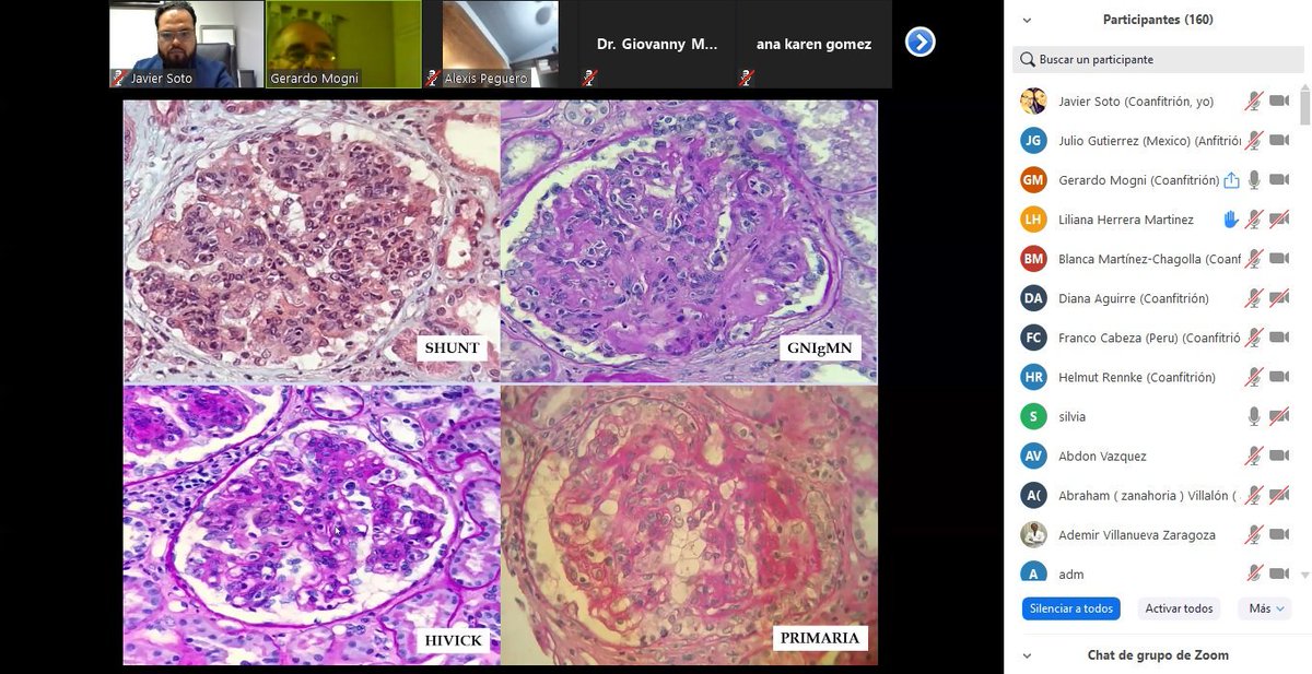 sotoO1o's tweet photo. MPGN no es una enfermedad, es un patrón de daño glomerular @gerardomogni @LGlomcon @GlomCon https://t.co/vugrbvbPJQ