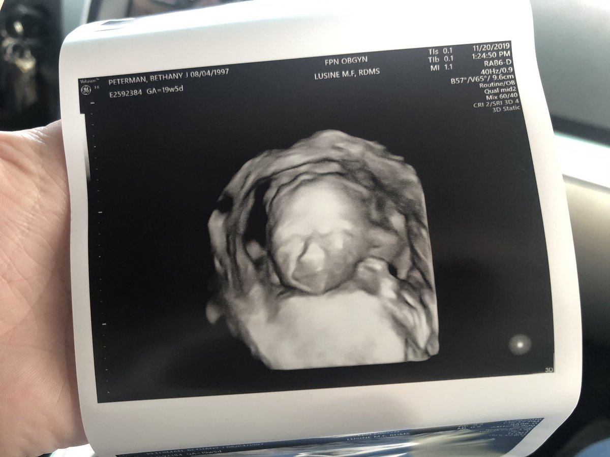 Bethscott42's tweet photo. Look at my little baby🥺❤️ https://t.co/3IqkHOee2A