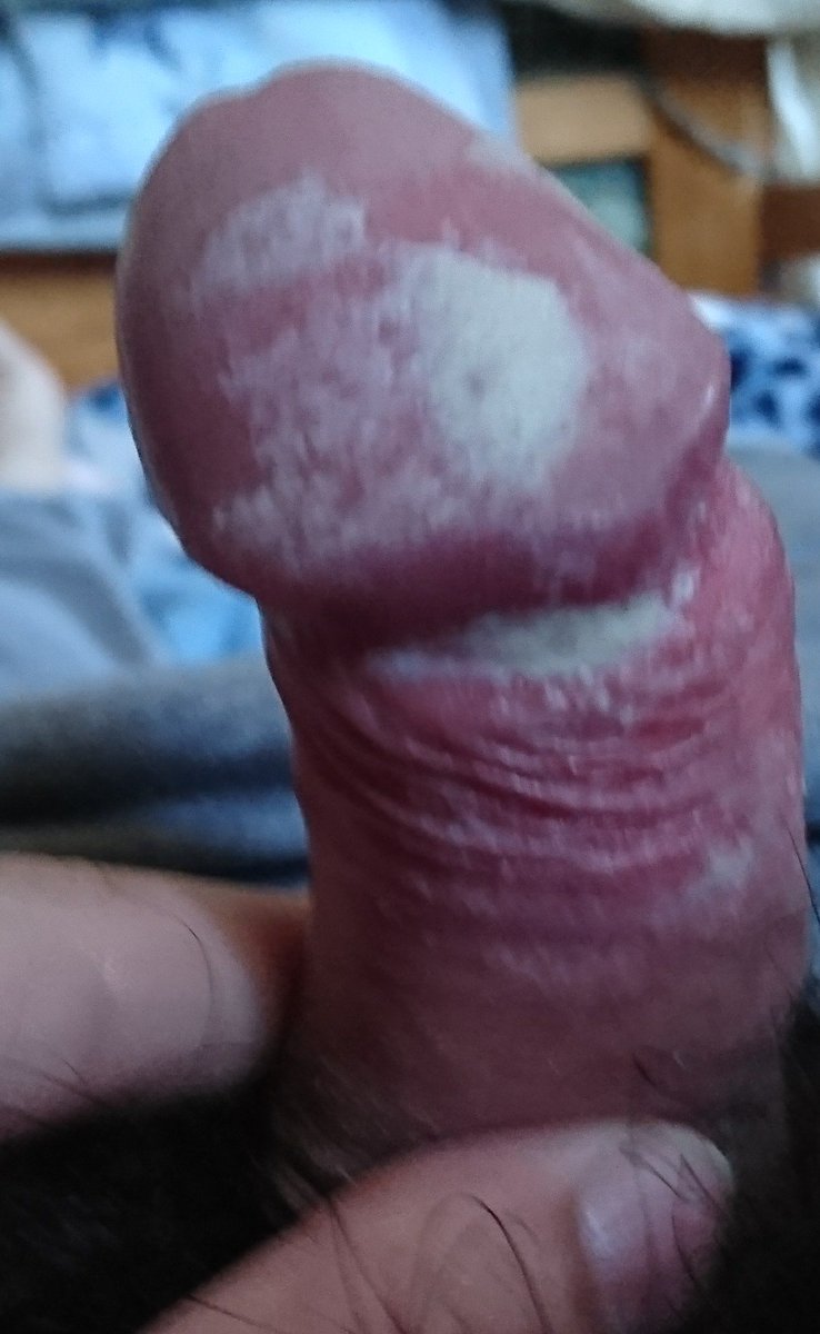 Smegmalover3's tweet photo. #smegma #dirtycock #dickcheese #smellycock #dirty #dirtygay https://t.co/1fA34wmzSB