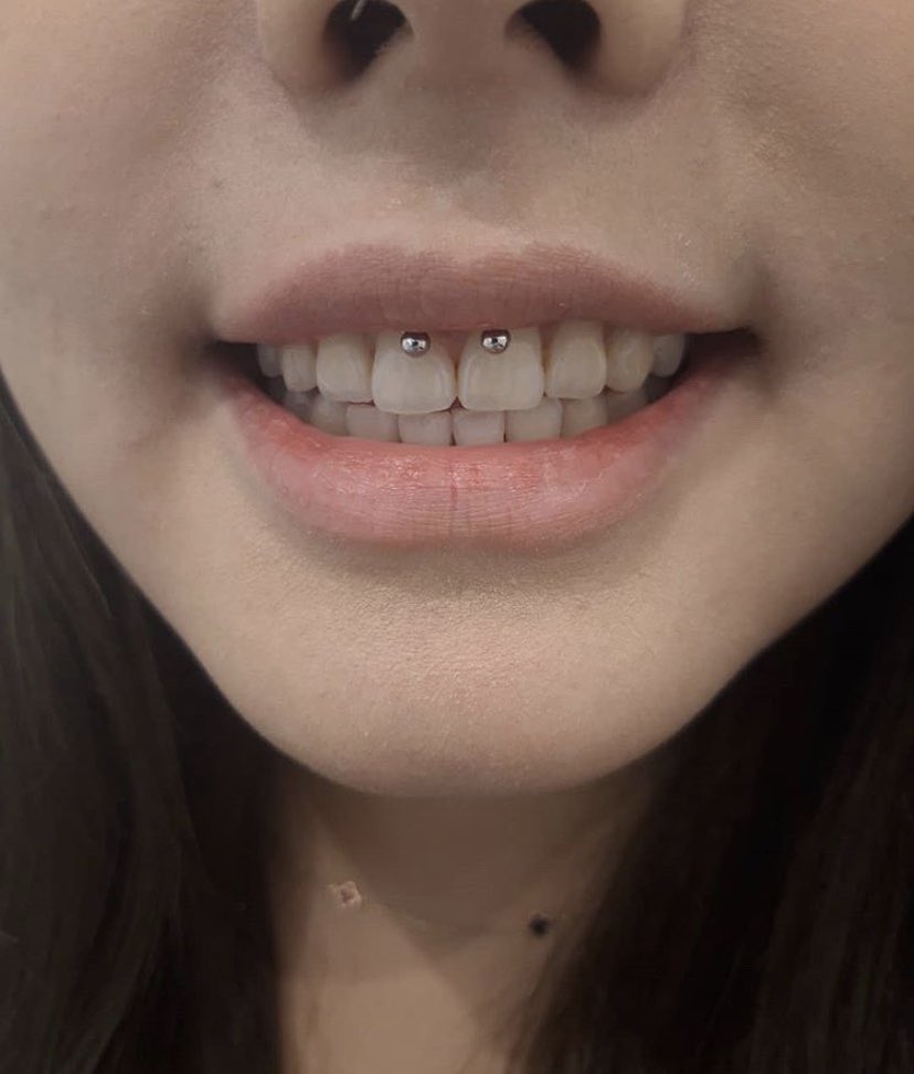 Piercing smiley Pictures, Pros,