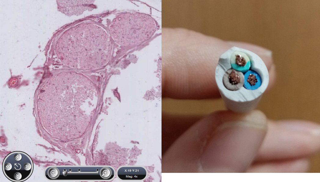 TFlanaganLab's tweet photo. Ahead of this afternoon's histology practical on peripheral nerve... #transversesection #longitudinalsection #peripheralnerve #fascicles #epineurium #perineurium #endoneurium #axons #ANAT20030 Basic tissues https://t.co/2tJywbzu8l