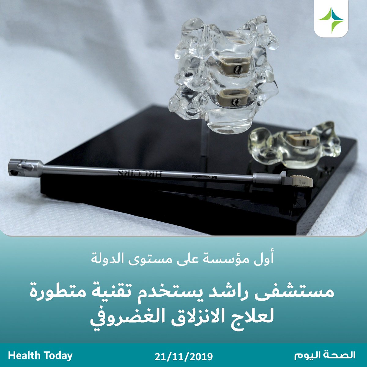 #مستشفى_راشد يبدأ بإستخدام تقنية متطورة لعلاج وإزالة آلام الغضروف العنقي بخطوة جراحية واحدة لتكون #صحة_دبي أول مؤسسة صحية على مستوى #الإمارات تستخدم هذه التقنية التي حققت نجاحا كبيرا في علاج عشرات الحالات المرضية في المستشفى دون أية مضاعفات سلبية. #DHAupdates
