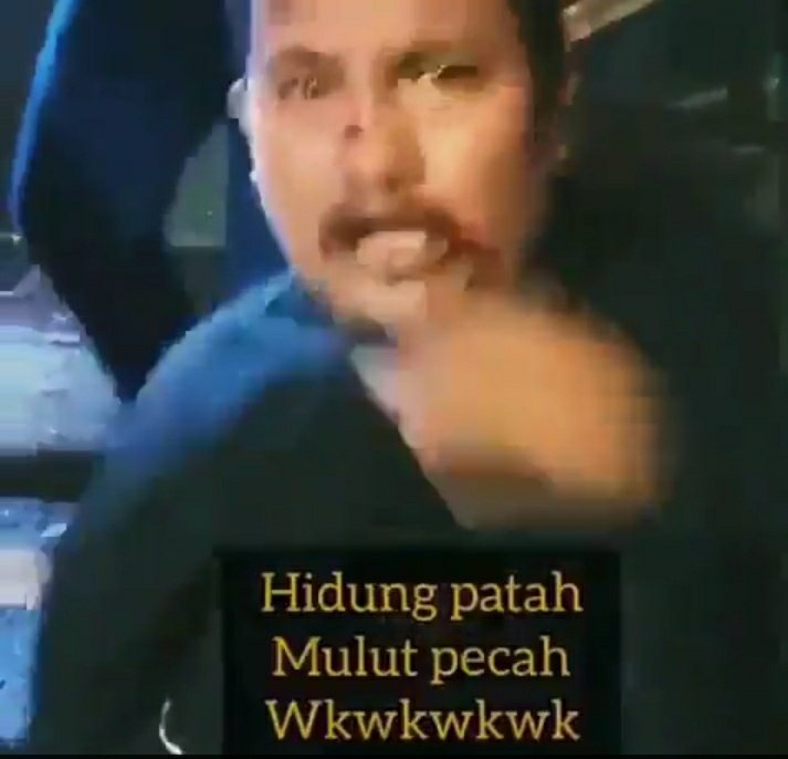 zoelfick's tweet photo. Kita gaungkan terus kasus dugaan penganiayaan atas suporter Indonesia oleh suporter timnas Malaysia. 

Semoga dgn ini @KEMENPORA_RI dengan Menpora Malaysia @SyedSaddiq sungguh-sungguh bergerak. https://t.co/bw2D9pezIq