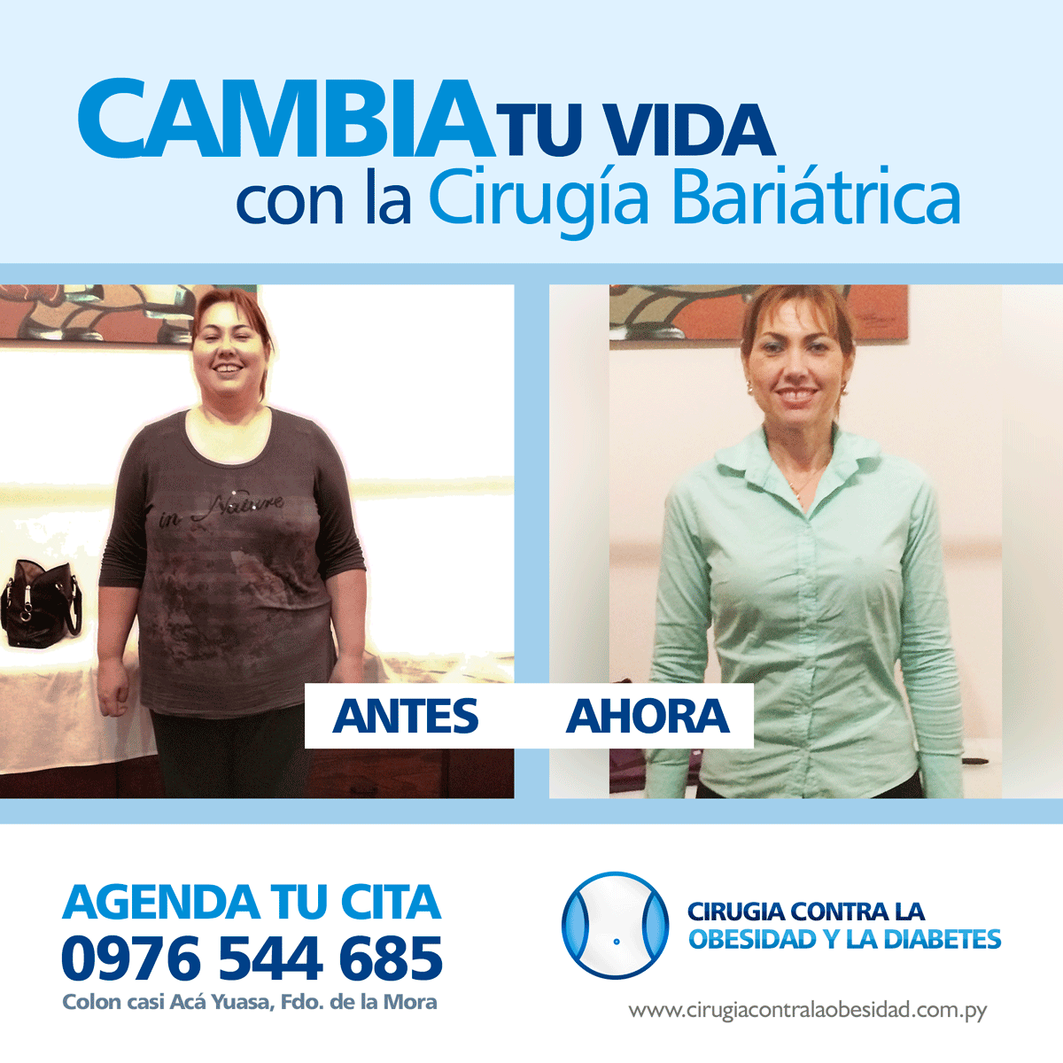 Bariatricapy's tweet photo. VIVA LIBRE DEL DIABETE Y LA OBESIDAD. Como llegar: 📍https://t.co/lCdVWc5n2b - 📲AGENDA TU CITA (0976) 544 685 #CirugiaBariatrica #VivirSinObesidad #VivirSinDiabetes https://t.co/nmjOrAjNwg