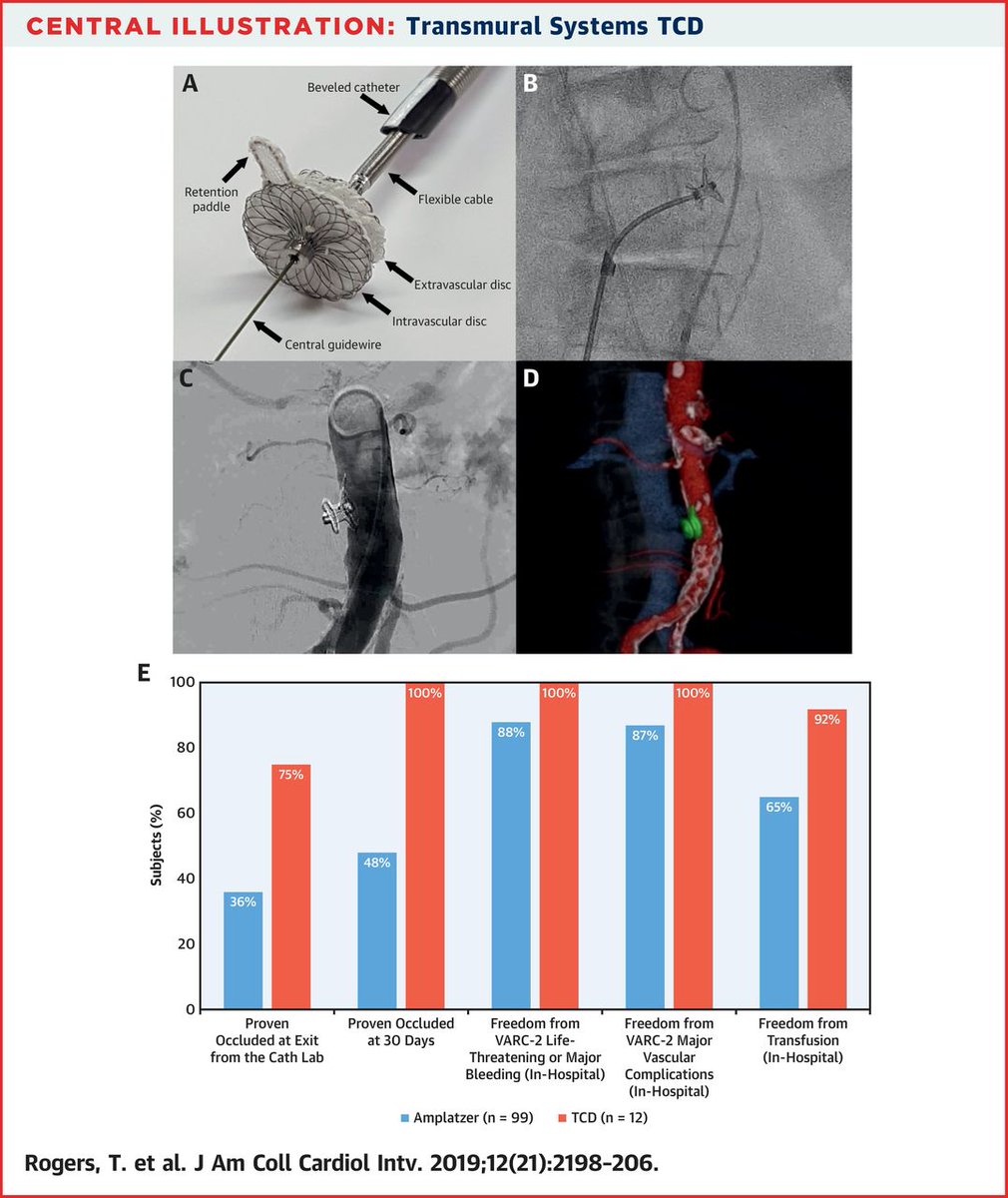 JACCJournals's tweet image. Novel dedicated #transcaval closure device simplifies large-bore aortic access and eliminates bleeding in an early feasibility study: bit.ly/2XqyCym #JACCINT #TAVR