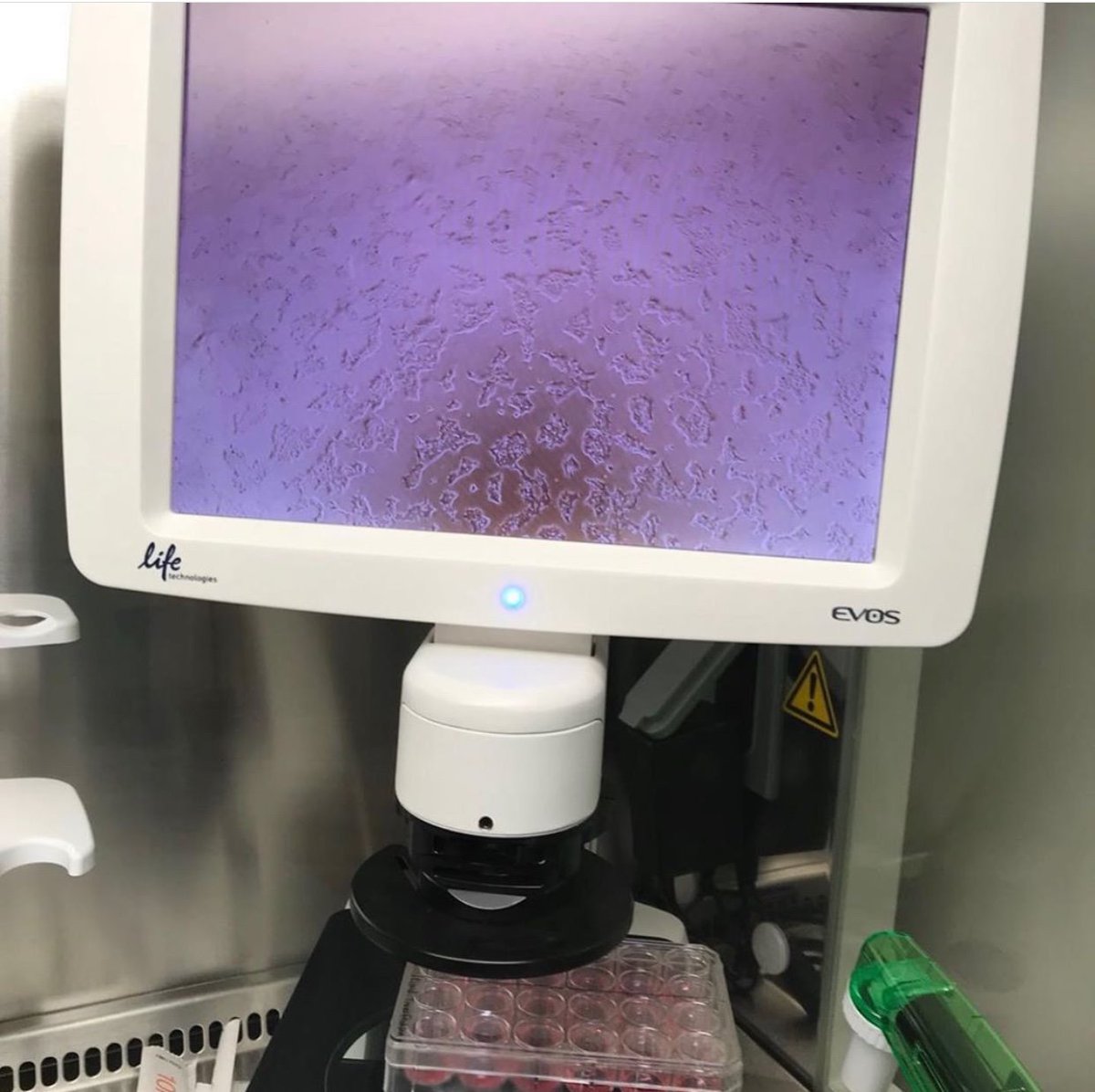 kids_who_code's tweet photo. Ashish Thakur's work at ThermoFisher involved CRISPR to successfully "knock" in the GFP gene into HEK293 cell line. https://t.co/KBkCOBTJIN