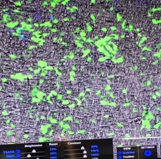 kids_who_code's tweet photo. Ashish Thakur's work at ThermoFisher involved CRISPR to successfully "knock" in the GFP gene into HEK293 cell line. https://t.co/KBkCOBTJIN