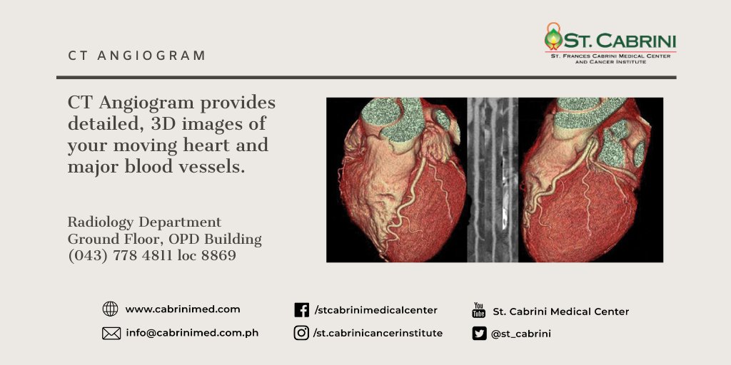 stcabrinimedctr's tweet image. Computed Tomography (CT) Angiogram is a test that uses X-rays to provide detailed pictures of the heart and the blood vessels. 

Consult your doctor to know if you could avail this test. For details, contact us at (043) 778 4811 loc 8869.

#ChooseStCabrini #CTAngiogram