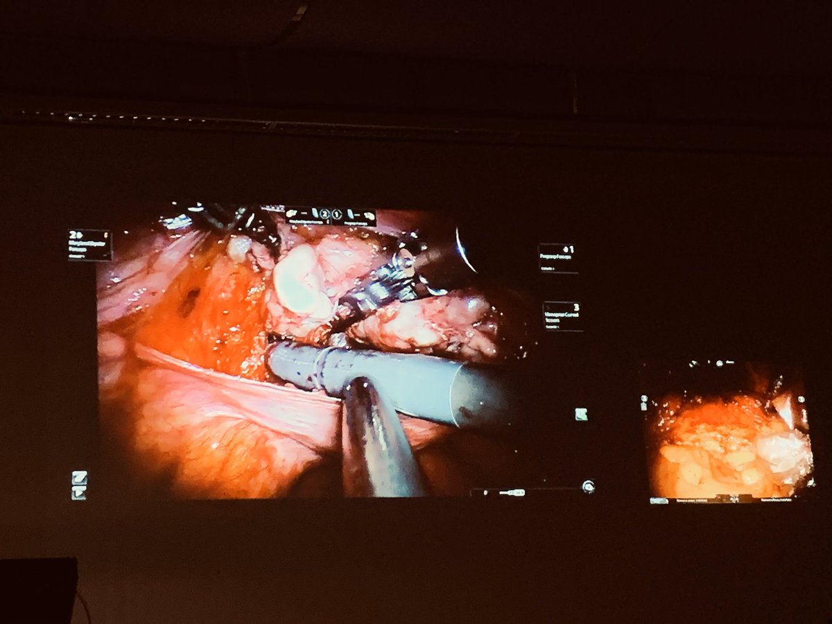 AlbertoCaviglia, MD, FEBU (@albertocavuro) on Twitter photo Second day <a href="/AroundProstate/">Around the Prostate 2019</a> <a href="/agalfano/">Antonio Galfano</a> <a href="/aldomassimo10/">Aldo Bocciardi</a> Prof Koon Rha and Prof Alexander Haese #prostatectomy #urology Second day <a href="/AroundProstate/">Around the Prostate 2019</a> <a href="/agalfano/">Antonio Galfano</a> <a href="/aldomassimo10/">Aldo Bocciardi</a> Prof Koon Rha and Prof Alexander Haese #prostatectomy #urology